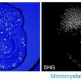 使用 SONICC 对蛋白质微晶检测和成像
