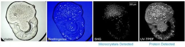 使用 SONICC 对蛋白质微晶检测和成像